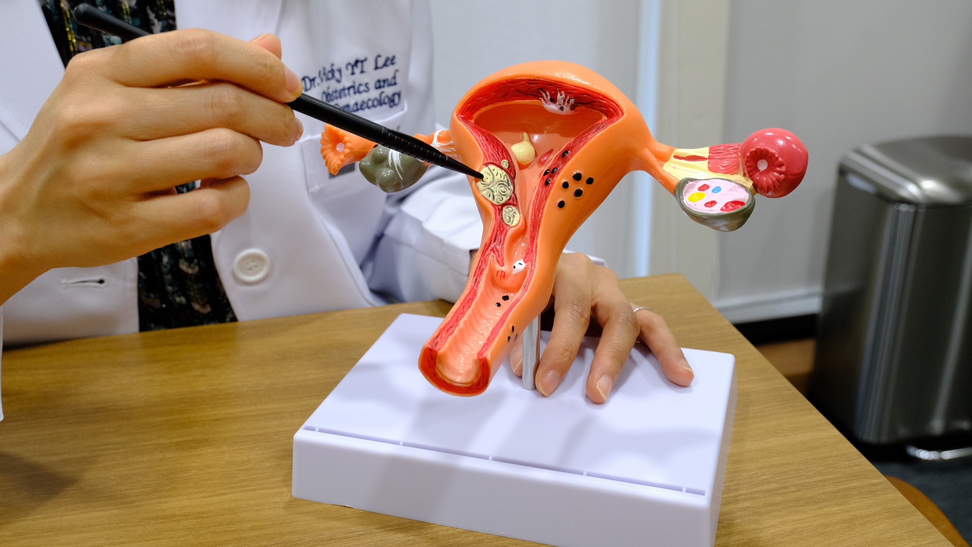 【健康】子宮肌瘤是什麼？婦產(chǎn)科醫(yī)生教你預(yù)防方法 