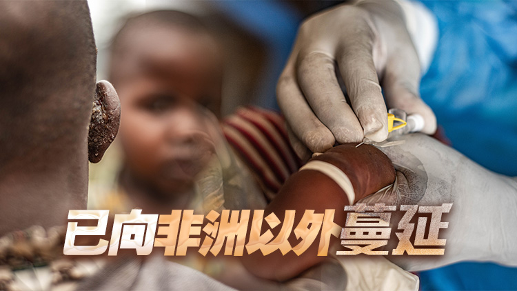 這次猴痘疫情，為什麼如此令人擔憂？