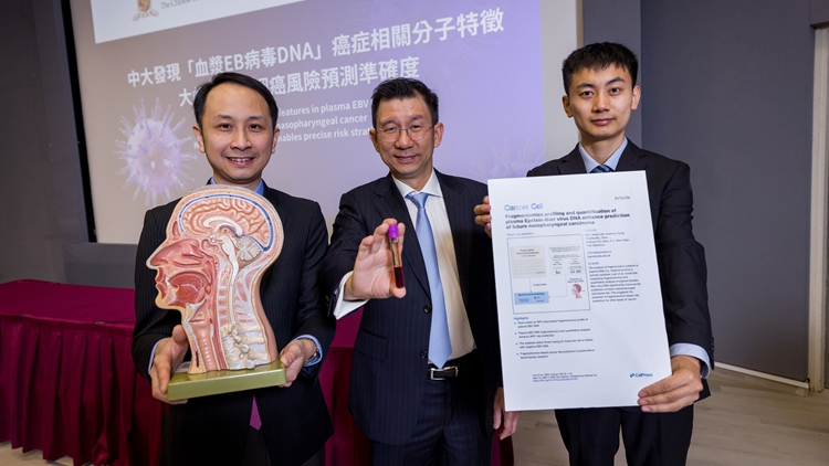 中大成功識別血漿EB病毒DNA 大幅提升鼻咽癌風(fēng)險(xiǎn)預(yù)測準(zhǔn)確度