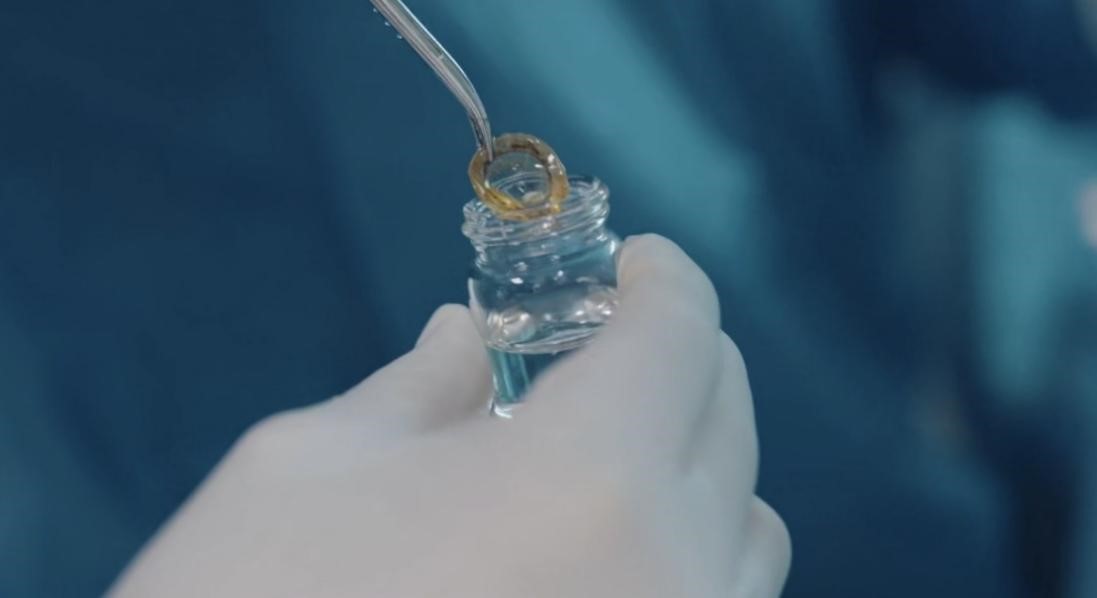 愛爾眼科已在全國16省建立62個(gè)角膜捐獻(xiàn)接收登記站 