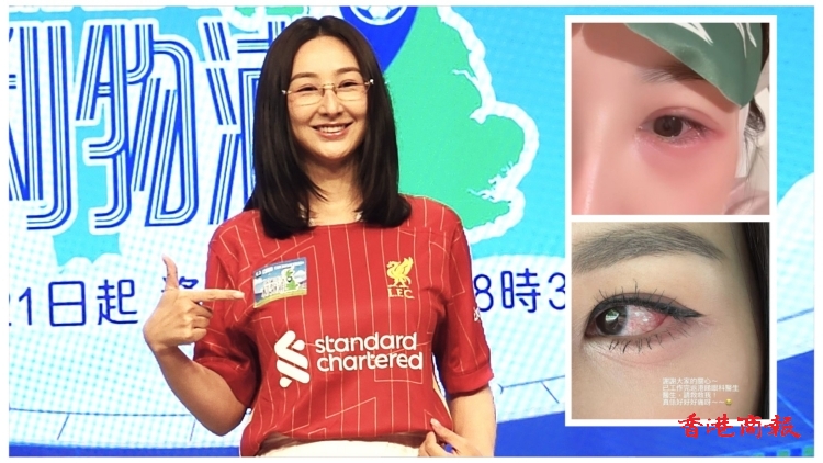 有片丨【娛樂】高海寧素顏現(xiàn)身：中西合璧治眼疾 康復(fù)八成進(jìn)度良好