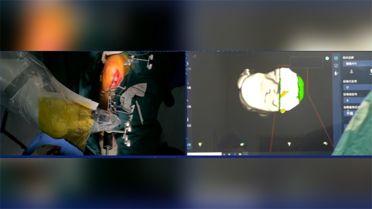 海拔4000米，來自深圳的它穩(wěn)穩(wěn)操作手術(shù)